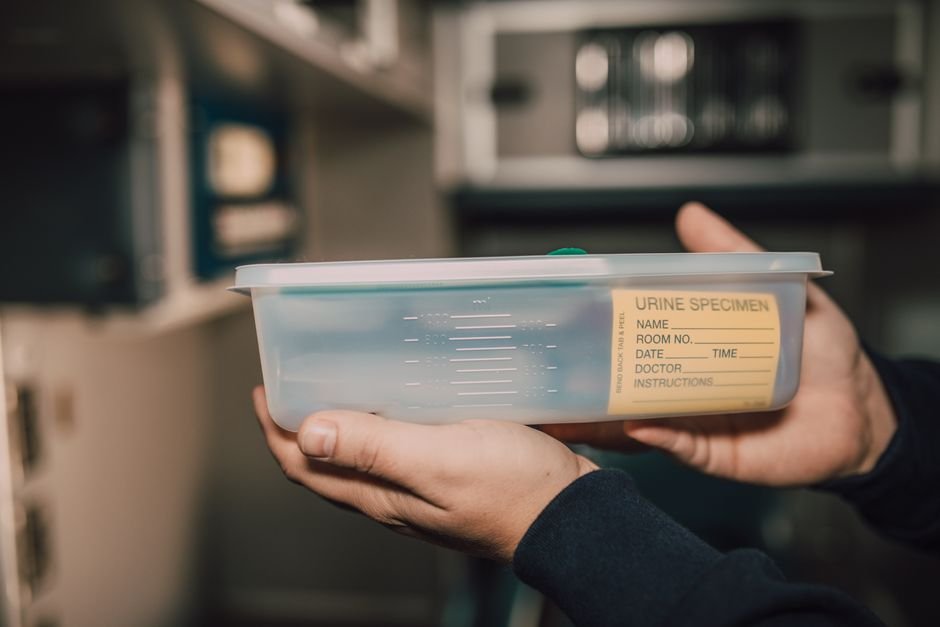 A hand holding a labeled urine specimen container