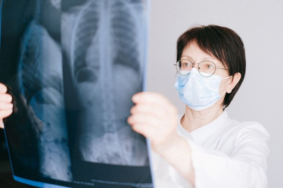 A doctor examining a chest x-ray