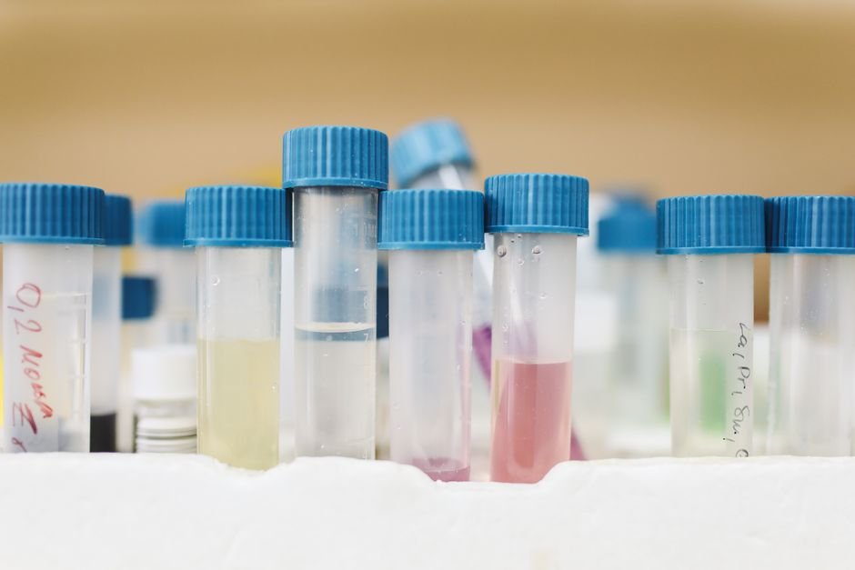 A row of labeled lab test vials with liquid samples