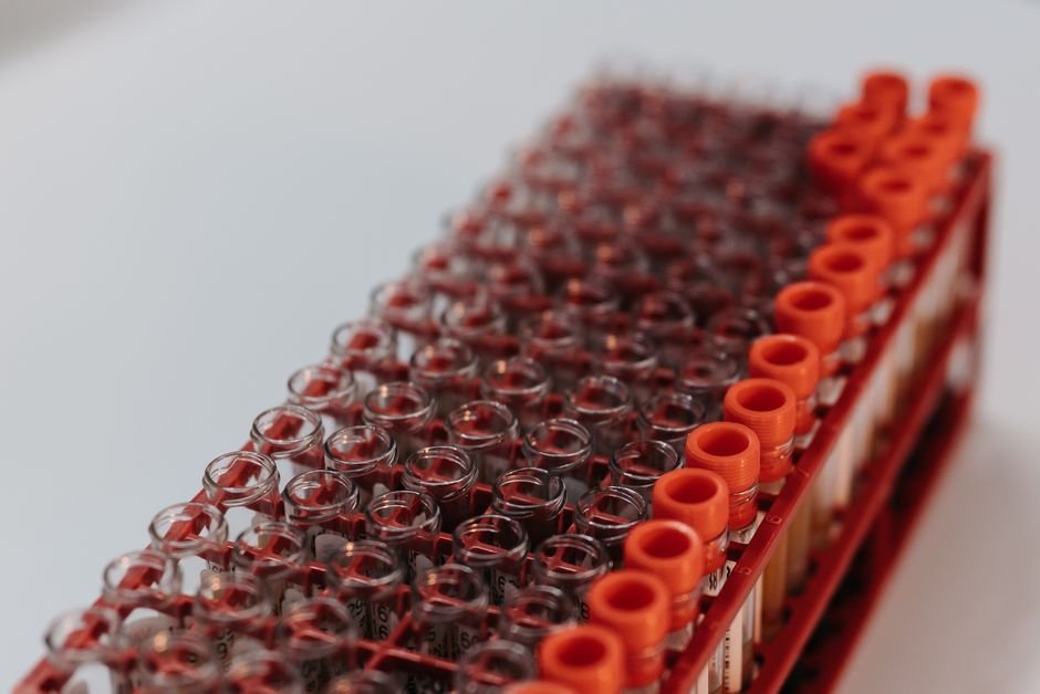 Rack of laboratory test tubes used for clinical sample testing