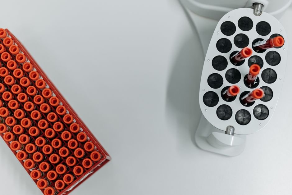 A rack of blood sample tubes in a lab centrifuge