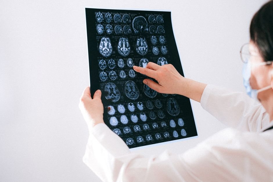 Doctor pointing at a brain scan printout